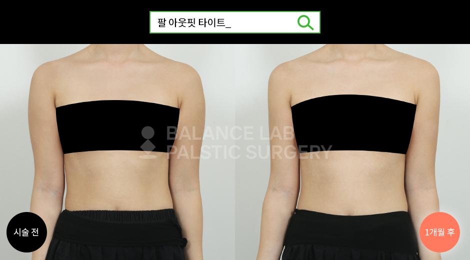 Before 4 Front