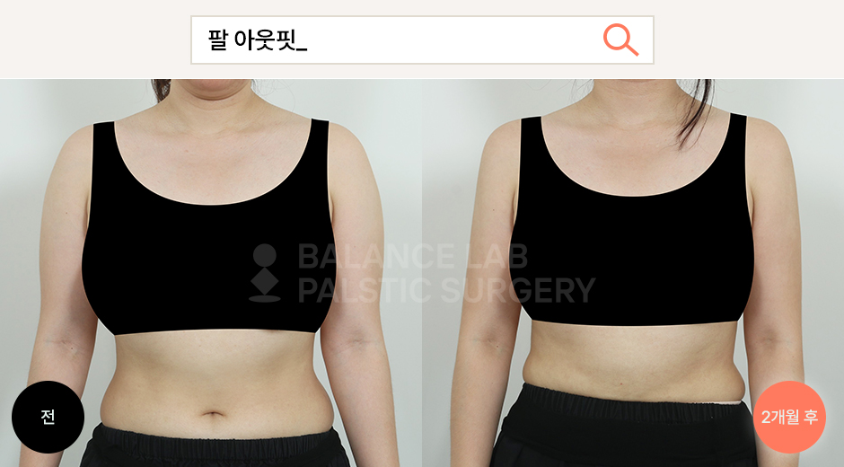 Before 3 Front