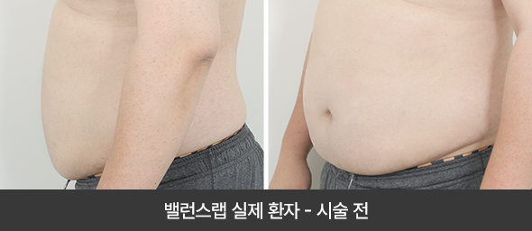 관리
