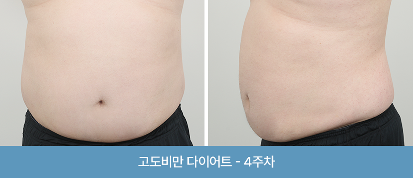 관리